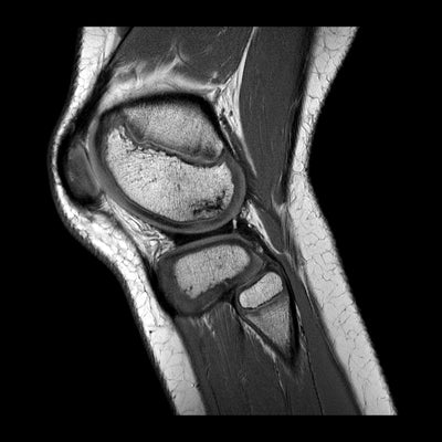 Imaging vs Pain